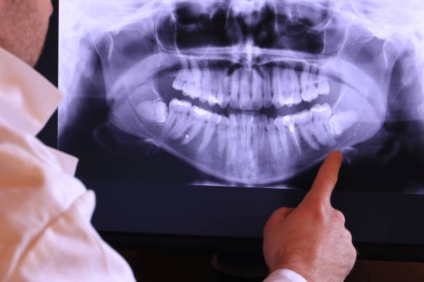 Best Dentist for Tooth Abscess  in Stanton, MI
